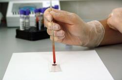揭秘达英35，副作用全解析，健康避孕新选择需谨慎