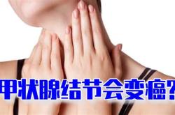 甲状腺结节能喝红酒吗好大夫