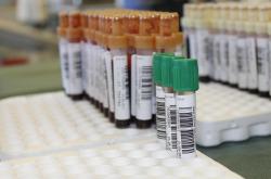 全面解读，保养的五大方面，让你的生活更健康、更高效